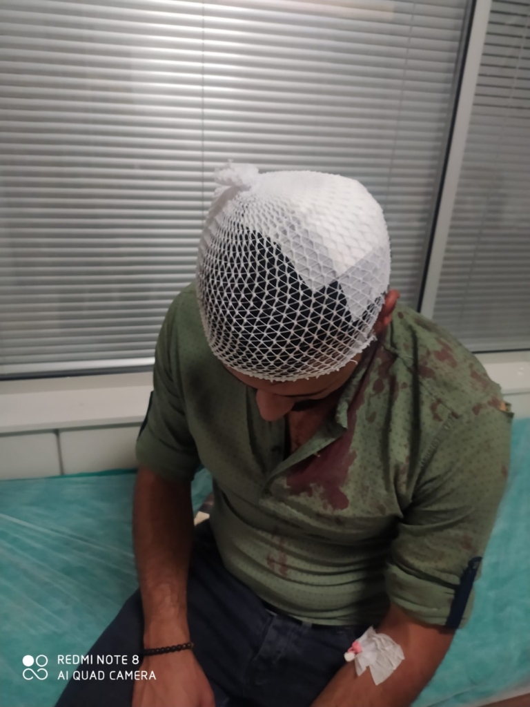 Van’da mülk sahibi sivil polis tarafından darp edildi - van kiraci mulk kavga 2