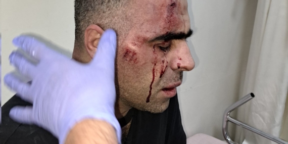 Gazeteci Sinan Aygül’e saldırı: 1 polis açığa alındı, 2 koruma gözaltında
