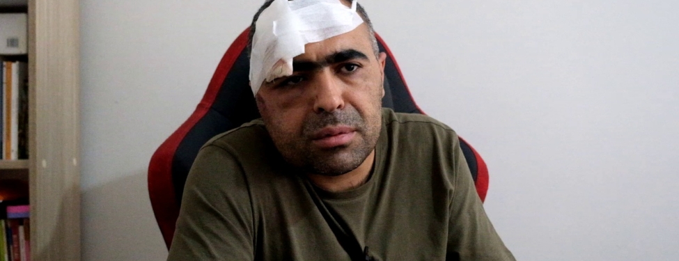 gazeteci sinan aygül saldırı röp (3)